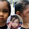 Pattaya school to investigate reports that 7 year old was beaten on the head with a stick causing swelling