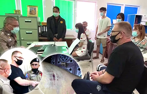 cowardly-norwegian-tor-zlatan-kicked-26-year-old-thai-woman-twice-in-the-legs cowardly-norwegian-tor-zlatan-kicked-26-year-old-thai-woman-twice-in-the-legs