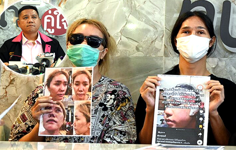 thai-women-plastic-surgery-nightmare-bangkok