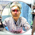 Another even more serious assault by a Swiss man on a frail Thai woman as Uli Fehr has his visa revoked 
