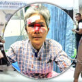 Another even more serious assault by a Swiss man on a frail Thai woman as Uli Fehr has his visa revoked 