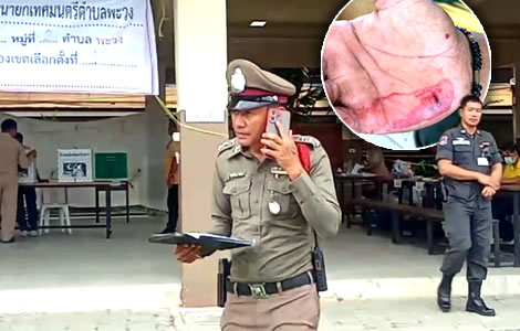 Policeman assaulted in Songkhla by henchmen of local political bigwig not allowed to take photos voting