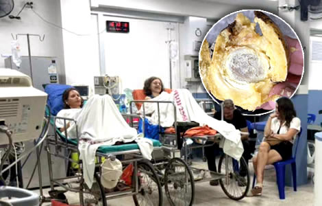 Russian women hospitalised in Surat Thani after eating mildly poisonous fruit in a National Park visit