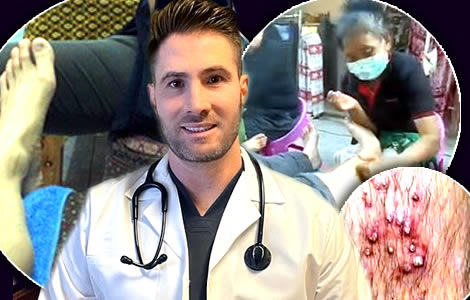 $5 back-alley massage not worth it. Tourist develops painful nightmare infection called folliculitis