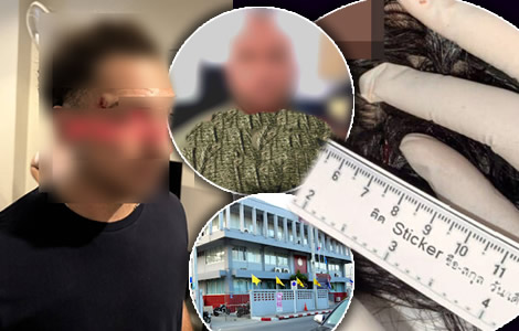 British man assaults French lover found in a hotel room with his Thai girlfriend. Denies injuring woman