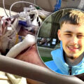 UK man fights for his life after horrific motorbike injuries in Pattaya. Doctors say he has a 30% chance