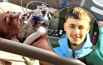 UK man fights for his life after horrific motorbike injuries in Pattaya. Doctors say he has a 30% chance