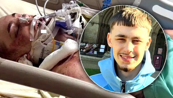 UK man fights for his life after horrific motorbike injuries in Pattaya. Doctors say he has a 30% chance
