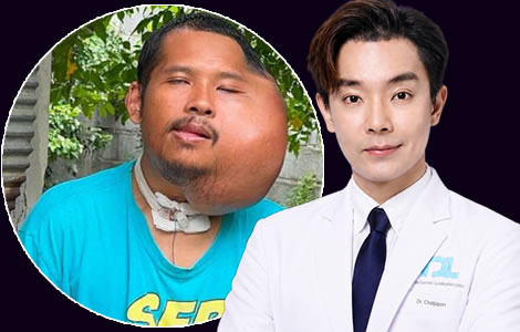 Horrific facial tumour alarms online viewers as doctor intervenes to try and help stricken 31 year old